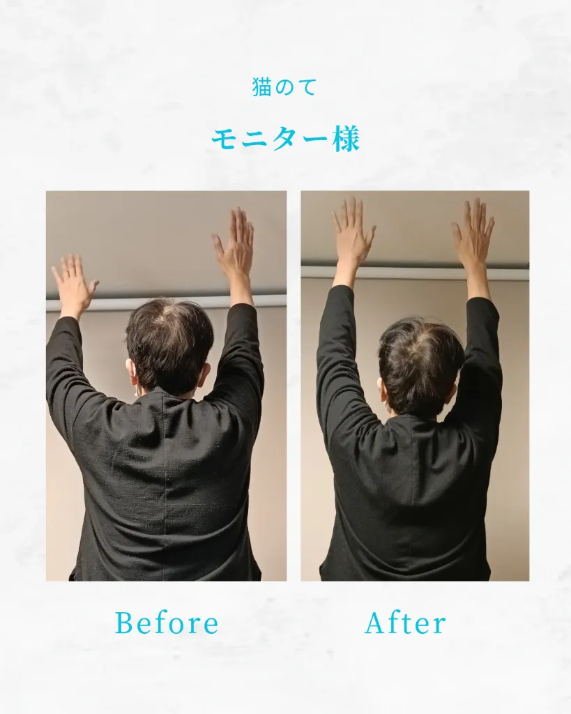 ビフォーアフター